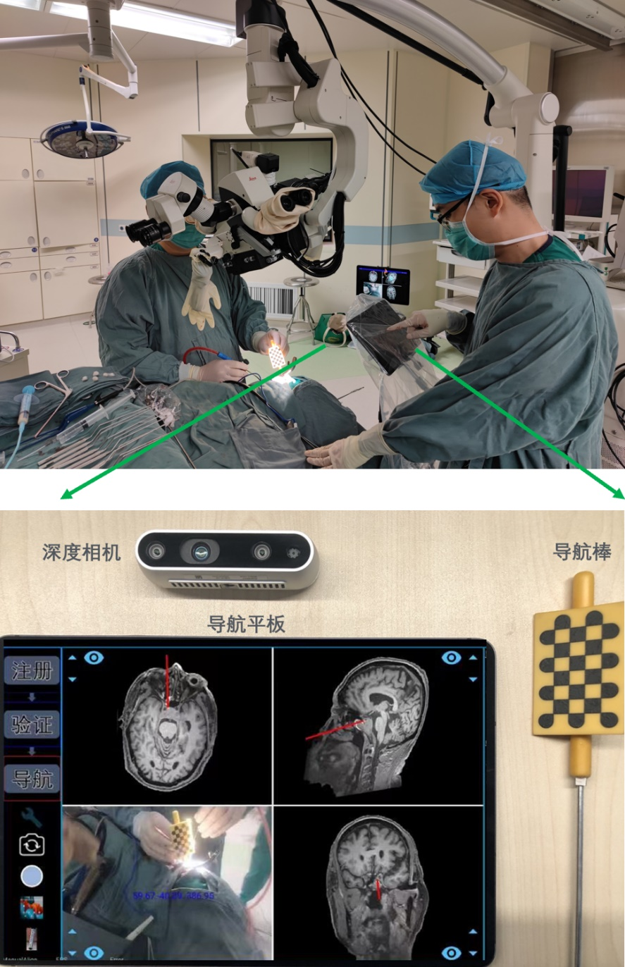 高精度、便携式、智能化，北京协和医院与腾讯联合发布国产手术导航系统    